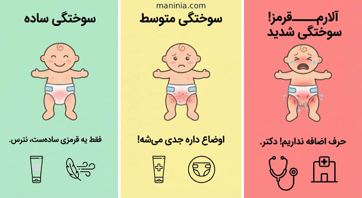بهترین کرم سوختگی نوزاد